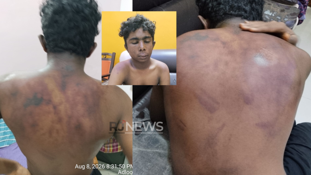 దమ్మాయిగూడ శ్రీచైతన్య హాస్టల్లో పదో తరగతి విద్యార్థిపై దారుణ దాడి